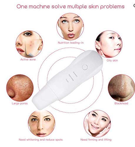 Ultrasonic Skin Spatula Facial Skin Scrubber – Deep Cleansing - Free Shipping