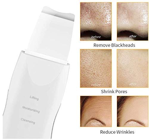 Ultrasonic Skin Spatula Facial Skin Scrubber – Deep Cleansing - Free Shipping