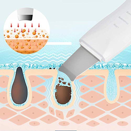 Ultrasonic Skin Spatula Facial Skin Scrubber – Deep Cleansing - Free Shipping