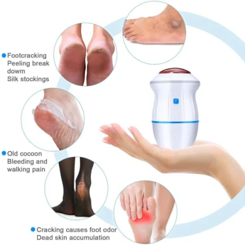 Electric Foot Grinder & Callus Remover | Rechargeable Pedicure - Image 3